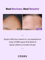 ⁦COSRX AHA/BHA Clarifying Treatment Toner- 150ml⁩ - الصورة ⁦10⁩