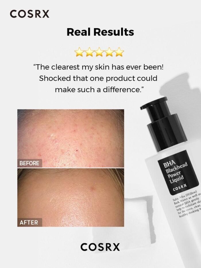 ⁦COSRX BHA Blackhead Power Liquid- 100ml⁩ - الصورة ⁦11⁩