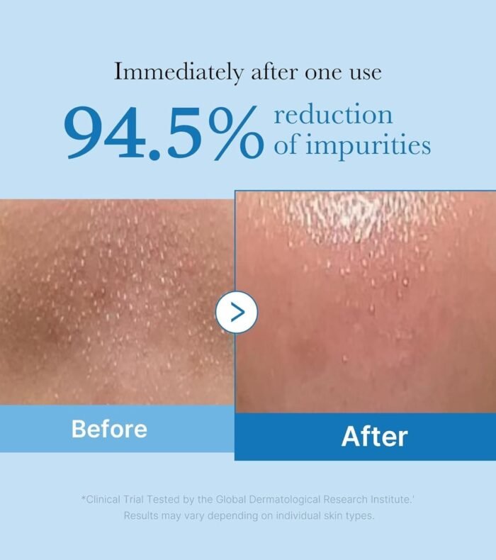 MEDICUBE-ZERO PORE BLACKHEAD DEEP CLEANSING OIL 205 Ml - Image 3