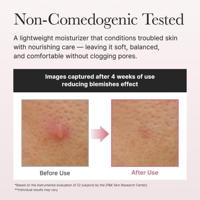 ⁦ARENCIA Red Smoothie Lotion 5, Face Moisturizer with Niacinamide 5%, Collagen, Peptide Complex, Hydrating Skin Care, 6.76 fl oz⁩ - الصورة ⁦4⁩