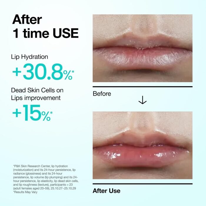 Anua PDRN Lip Serum, Long-Lasting Moisture for Dry, Cracked Lips, Non-Adhesive Lip Care with Salmon DNA, Hyaluronic Acid & Collagen, Korean Skincare, 10 ml - Image 4