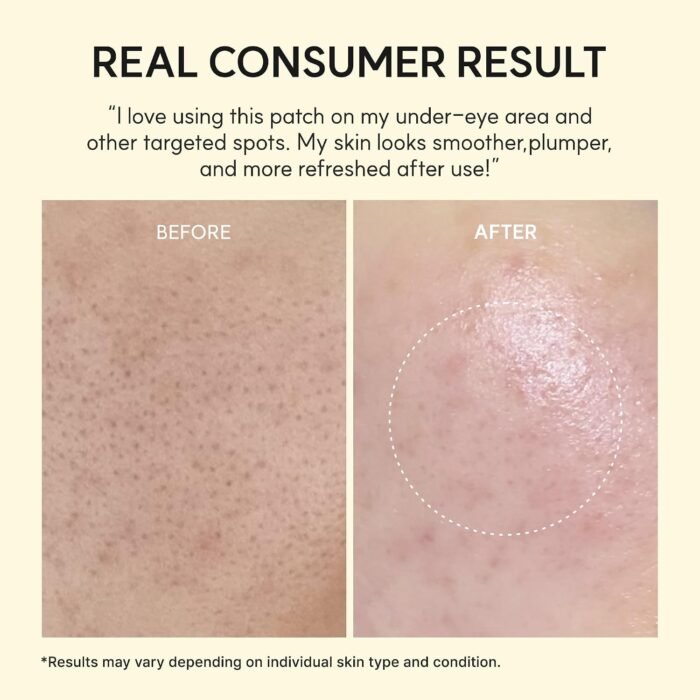 ⁦ARENCIA Retinal Boosting Eye Mask, Hydrogel Under Eye Patches with Peptides for Dark Circles, Puffiness, Fine Lines, 60 Patches⁩ - الصورة ⁦6⁩
