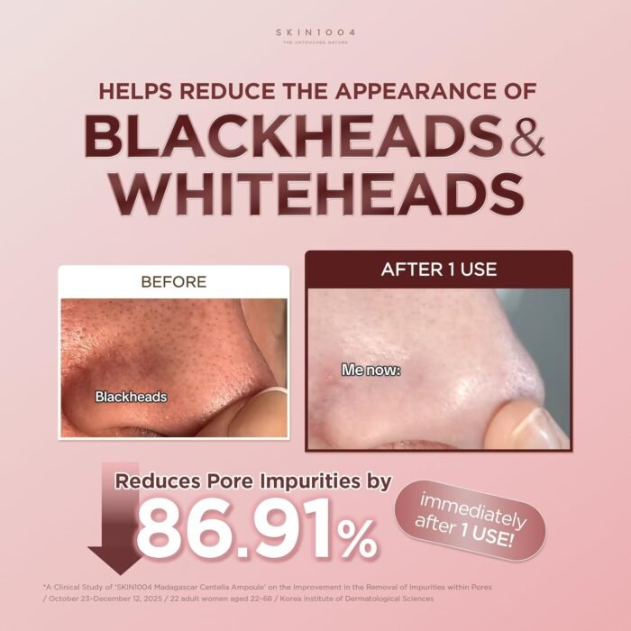 ⁦SKIN1004 Madagascar Centella Poremizing Quick Clay Stick Mask 27g⁩ - الصورة ⁦4⁩