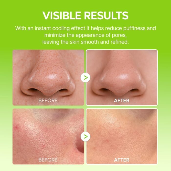 Dr. Melaxin Cactox Pore Relief Multi Balm Stick: Refreshing and Decongestant, Shrinks Pores, Reduces Swelling and Enlarged Pores, - Image 4