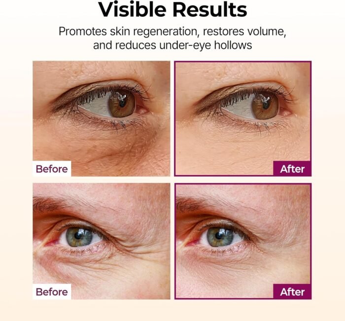 ⁦Dr.Melaxin Cemenrete Calcium Volume Multibalm 9G⁩ - الصورة ⁦4⁩