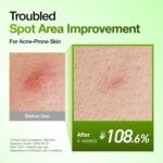 Anua Azelaic Acid 10 Hyaluron Redness Soothing Serum, Facial Serum for Sensitive skin, Hyaluronic Acid, Niacinamide, Spot Care, Natural Color, Vegan, Korean Skincare (30ml/ 1.01 fl oz.) - الصورة 5